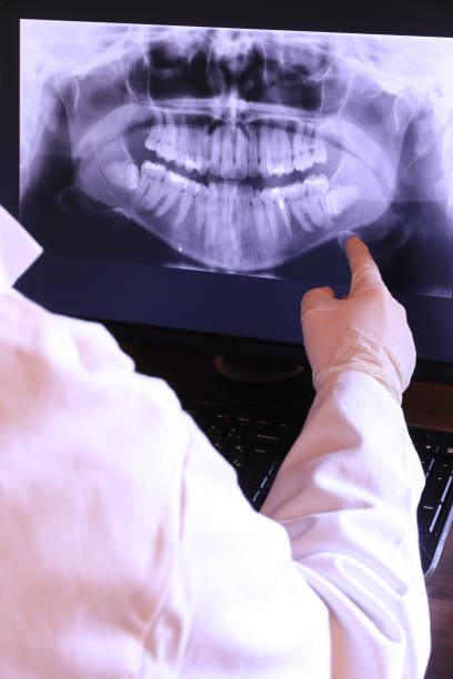 Best Emergency Treatment for Dental Infections or Abscesses in Bogata, TX