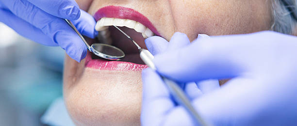 Best Emergency Tooth Extraction in Bogata, TX